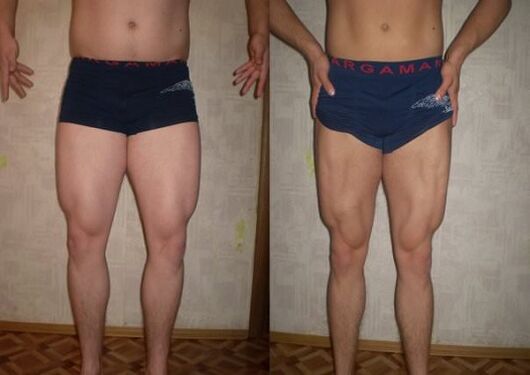 sateuacan sareng saatos nuturkeun diet keto